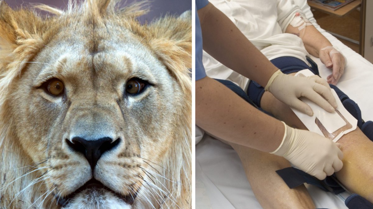 Lejonet slet sönder 18-åringens ben.